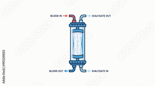 Diagram of a hemodialysis machine, showing blood and dialysate flow. Blood enters and exits, while dialysate flows in and out, creating a filter.