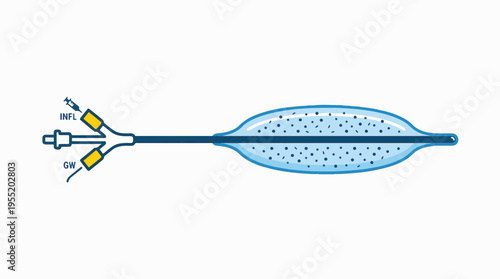 Medical device diagram showing a balloon catheter with proximal ports (inflation, guidewire) and an inflated, oval-shaped distal balloon filled with small particles.