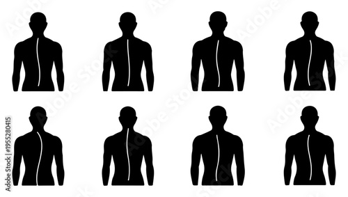 Silhouettes of human figures showcasing spinal anatomy and posture variations
