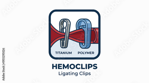 An illustration comparing titanium and polymer surgical ligating clips (Hemoclips) shown compressing a red vessel, highlighting two different material types.
