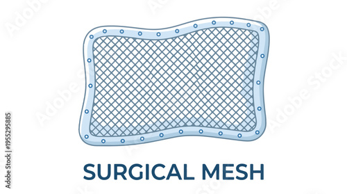 A cartoon illustration of a flexible surgical mesh with rounded corners and reinforced edges, set against a white background.