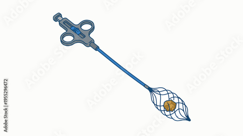 An illustration of a medical stone retrieval basket with a long blue shaft and handle, holding a brownish, irregular stone. Used in endoscopic procedures.