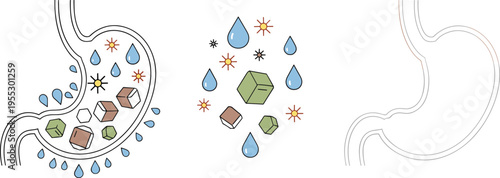 Kidney stone formation and urinary tract diagram with mineral crystals dehydration droplets medical urology health vector illustration