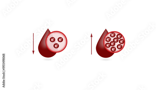 Hyperkalaemia, high plasma potassium level and Hypokalaemia, low plasma potassium level. Potassium K excess and deficit electrolyte disorders, blood test tube, Scientific design. Vector illustration
