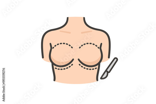 Female Breast with Surgical Incision Lines and Scalpel - Cosmetic Surgery Illustration