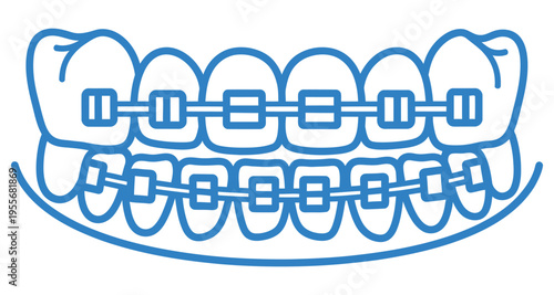 Dental Braces Correction Teeth Alignment Illustration Line Art Stock