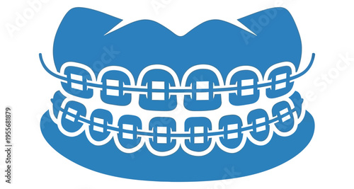 Dental Braces on Teeth Correction Alignment Straightening Orthodontic Treatment