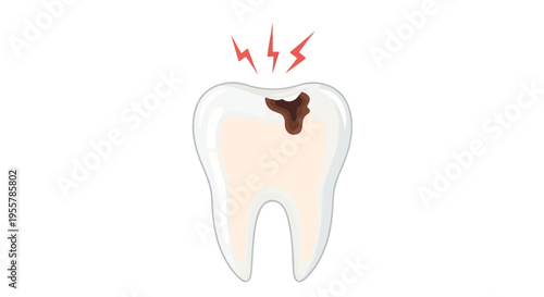 Illustration of a tooth with a cavity and pain lines, against a clean white background.