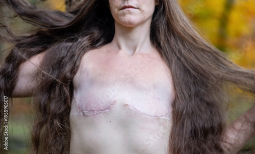 Portrait of a woman with long hair showing the scars of a double mastectomy. Her strength and presence radiate through the image, embracing healing, identity, and body acceptance