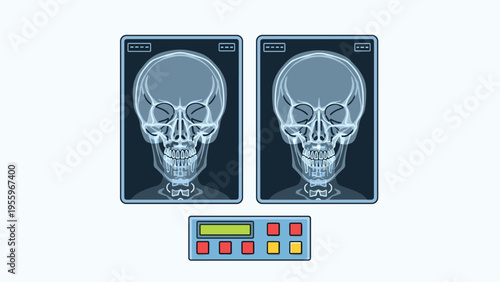 Medical X-ray images show the frontal view of two human skulls next to a control panel in a healthcare facility setting.