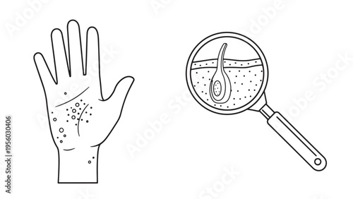 Skin Allergy Rash Examination With Magnifying Glass Illustration Representing Dermatology Diagnostics Healthcare Research And Clinical Risk Assessment