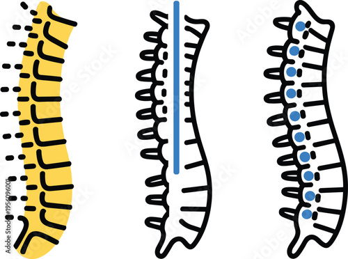 Human spine anatomy illustration with vertebrae structure and spinal column variations, medical educational diagram showing backbone alignment and health concept – vector illustration