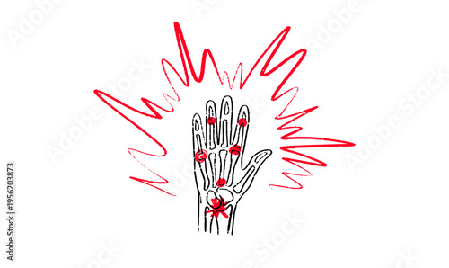 Arthritis Sketch Poster