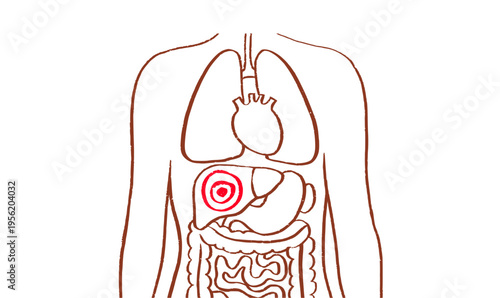 Liver disease concept