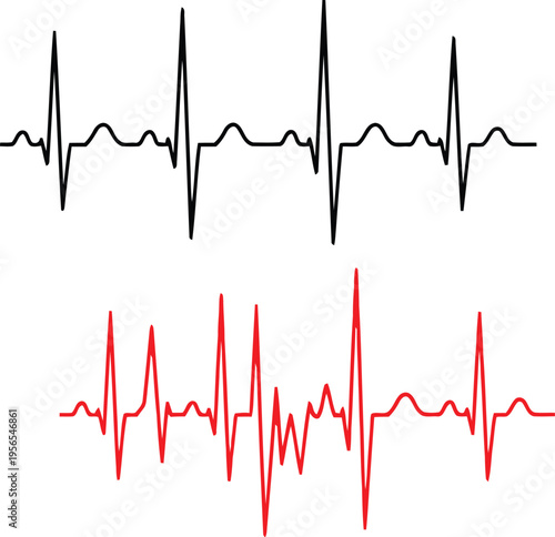 Comparative illustration of a normal heartbeat and an irregular cardiac rhythm in medical symbols Vector