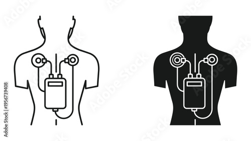 Infusion pump and IV bag icon on human back outline and silhouette, medical equipment illustration