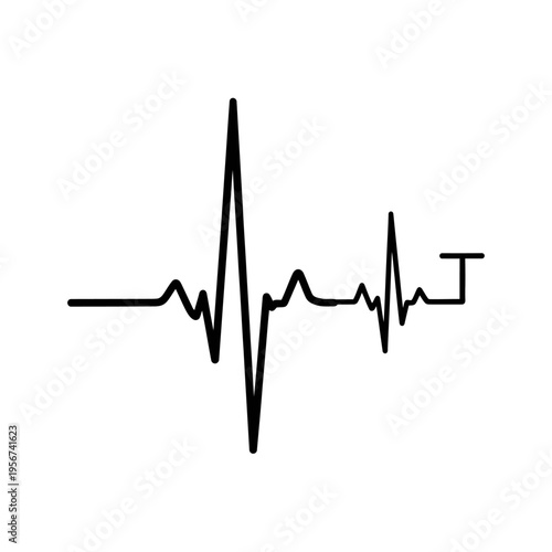 Electrocardiogram reading on a medical chart