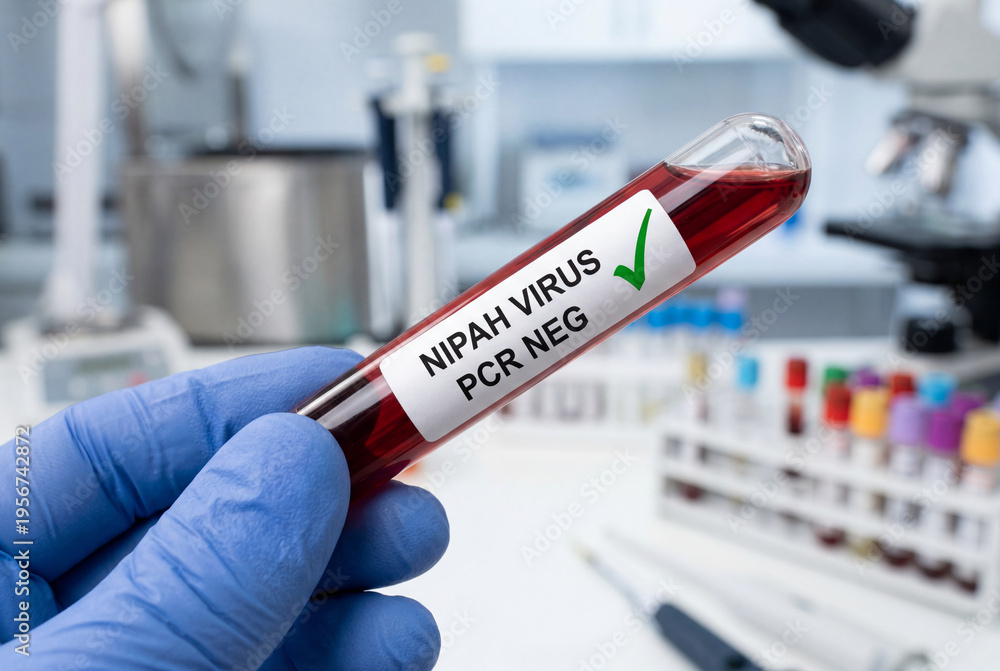 Naklejka premium A gloved hand holds a blood sample tube displaying a negative test result for a viral infection