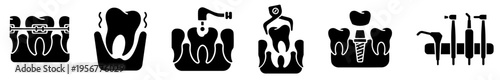 Dental Procedures Care Icon Set Dental Implant Surgery, Cavity Treatment with Drill, Tooth Extraction with Forceps, Loose Tooth Pain and Featuring Orthodontic Braces. Toothache Symptoms, 