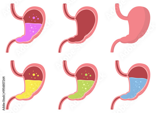 Illustrated stomach diagrams showcasing different digestion or health states.
