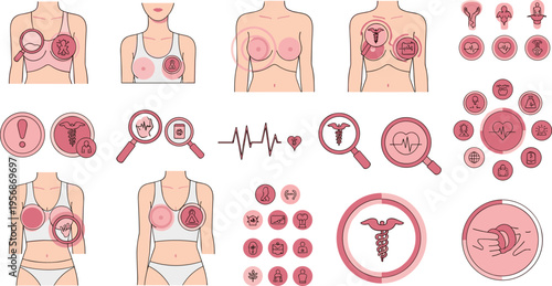 Breast Cancer Medical Illustration Set with Tumor Stages Anatomy Diagrams Cell Growth and Diagnostic Symbols for Healthcare Education Awareness and Clinical Use