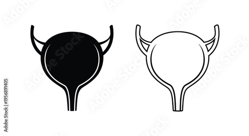 Anatomical illustration of a human bladder in dual color schemes