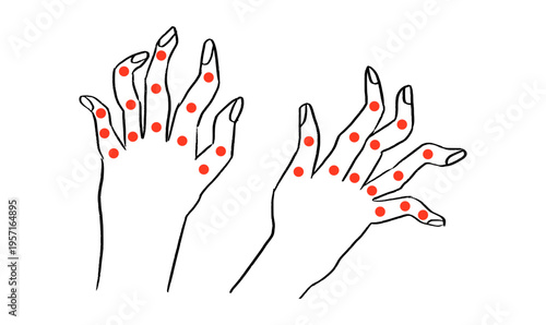 Arthritis Sketch Poster