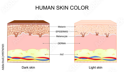 Human skin color. Different between Light and Dark skin.