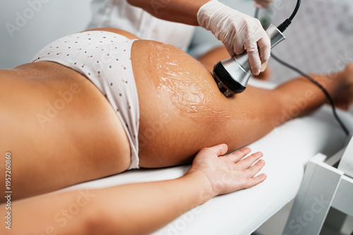 A professional therapist performs a radiofrequency skin tightening procedure on a female patient's buttocks to reduce cellulite and improve skin elasticity in a modern beauty spa.
