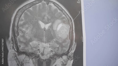 x ray image of human brain