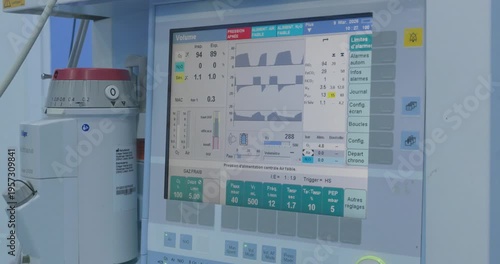 Close-up of a medical ventilator screen displaying real-time respiratory waveforms and patient vital signs in an intensive care unit (ICU).