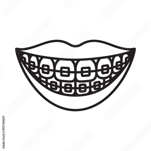 Simple black and white illustration of a smiling mouth with dental braces