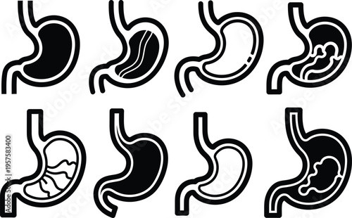 Anatomical variations of the human stomach