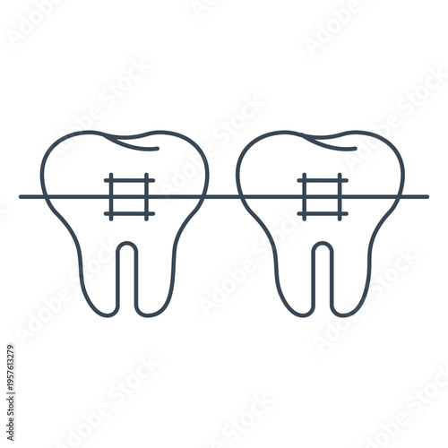 Sketch of two molars with braces