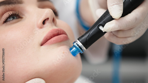 Hydrafacial treatment in beauty clinic for deep skin cleansing and hydration using modern technology. Skincare concept.
