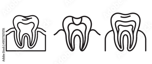 A linear illustration depicts three stages of tooth decay progressing from healthy to severely damaged