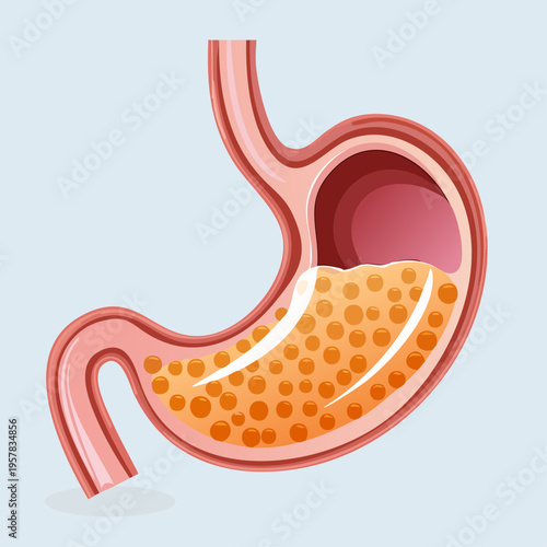 Cross-Section Illustration of Human Stomach with Gastric Contents