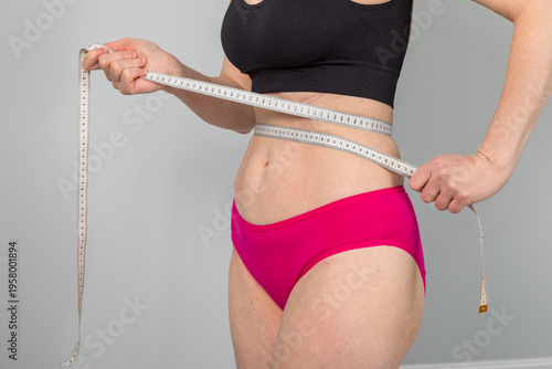 Bild auf Leinwand Woman measuring her waist with a tape after abdominal surgery