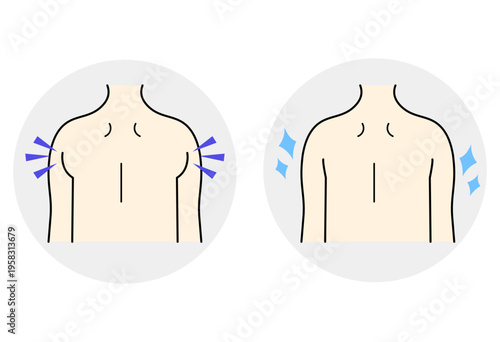 Underarm And Back Fat Before And After Comparison Illustration Showing Reduction Of Bulging Fat And Body Contouring For Beauty And Weight Loss Content
