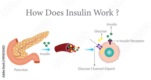 Educational medical illustration showing pancreas releasing insulin, insulin binding to cell receptors, and glucose entering cells through open glucose channels.