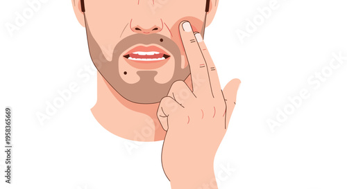 A man's finger points to a mole on his bearded cheek, with his mouth slightly open.