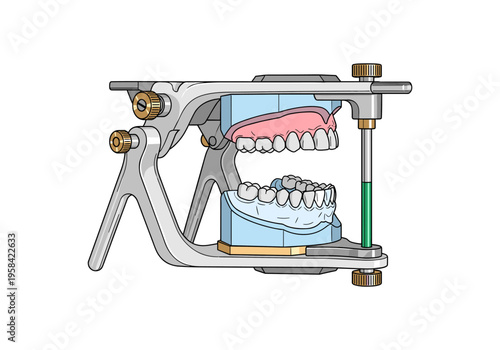 Dental articulator with upper and lower jaw models and teeth