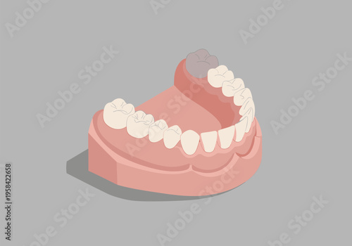 Illustration of a dental prosthesis with healthy and damaged teeth on a gray background
