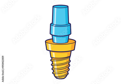 Stylized dental implant with screw base and blue abutment on white background
