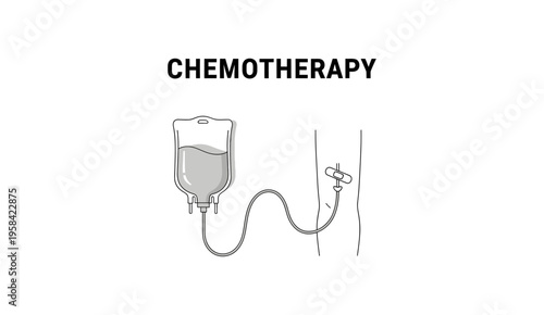 Chemotherapy medical illustration with IV drip bag and patient's arm line art.