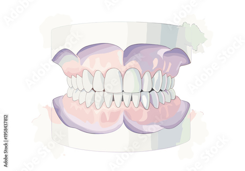 Illustration of a full set of dentures on a dental model showing upper and lower teeth