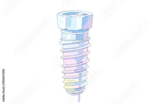Close-up illustration of a single dental implant screw with pastel colors