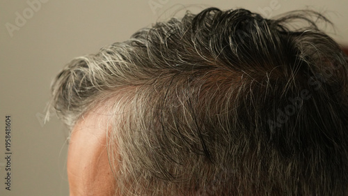 Foto White hair and gray hair of man, hair health problems with hair loss and thinning