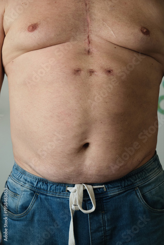 close-up of a fat man's belly