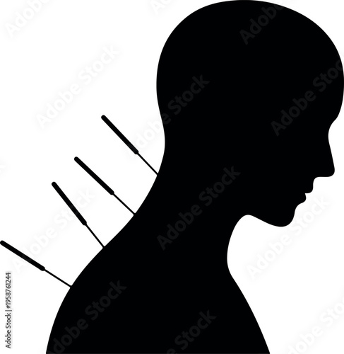 Woman silhouette receiving acupuncture therapy on neck and back